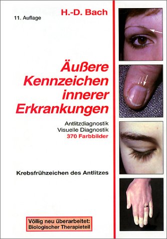 "Äußere Kennzeichen innerer Erkrankungen, Bd.1, Antlitzdiagnostik, Visuelle Diagnostik, Krebsfrühzeichen des Anlitzes" von Hans-Dieter Bach